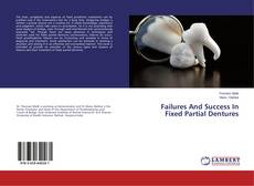 Couverture de Failures And Success In Fixed Partial Dentures