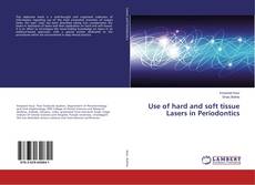 Bookcover of Use of hard and soft tissue Lasers in Periodontics