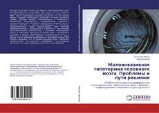 Bookcover of Малоинвазивная гипотермия головного мозга. Проблемы и пути решения