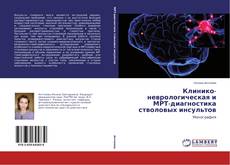 Клинико-неврологическая и МРТ-диагностика стволовых инсультов的封面