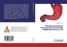Portada del libro de Малоинвазивные технологии в лечении перфоративных язв