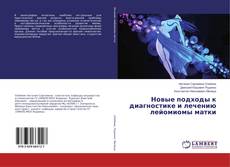 Copertina di Новые подходы к диагностике и лечению лейомиомы матки