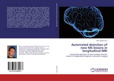 Automated detection of new MS lesions in longitudinal MRI kitap kapağı