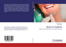 Basics in Implants的封面