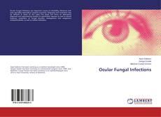 Couverture de Ocular Fungal Infections