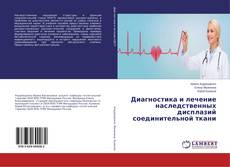 Bookcover of Диагностика и лечение наследственных дисплазий соединительной ткани
