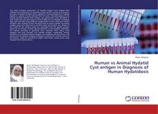 Copertina di Human vs Animal Hydatid Cyst antigen in Diagnosis of Human Hydatidosis