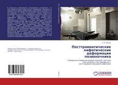 Couverture de Посттравматические кифотические деформации позвоночника