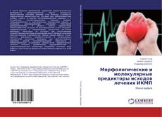 Bookcover of Морфологические и молекулярные предикторы исходов лечения ИКМП