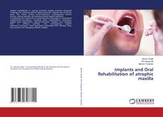 Обложка Implants and Oral Rehabilitation of atrophic maxilla