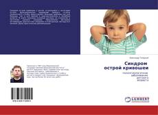 Capa do livro de Синдром острой кривошеи 