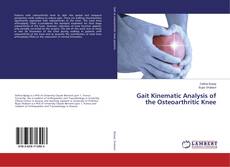 Buchcover von Gait Kinematic Analysis of the Osteoarthritic Knee