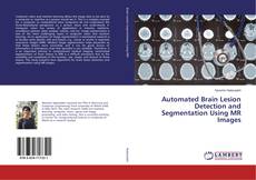 Copertina di Automated Brain Lesion Detection and Segmentation Using MR Images