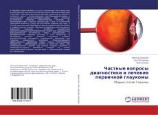 Capa do livro de Частные вопросы диагностики и лечения первичной глаукомы 