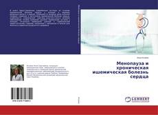 Buchcover von Менопауза и хроническая ишемическая болезнь сердца