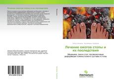 Couverture de Лечение ожогов стопы и их последствия