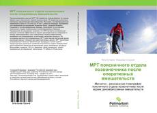 Bookcover of МРТ поясничного отдела позвоночника после оперативных вмешательств