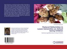 Buchcover von Postural Deformities in Lower Extremities on School Going Children