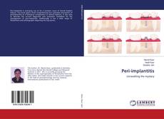 Buchcover von Peri-implantitis