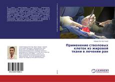 Buchcover von Применение стволовых клеток из жировой ткани в лечении ран