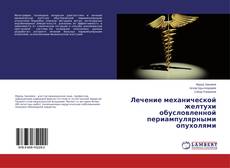 Buchcover von Лечение механической желтухи обусловленной периампулярными опухолями