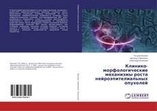 Couverture de Клинико-морфологические механизмы роста нейроэпителиальных опухолей