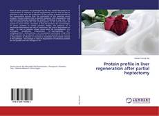 Copertina di Protein profile in liver regeneration after partial heptectomy