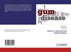 Copertina di Gums in normal and inflammation