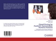Copertina di Closed Pinning for Paediatric Supracondylar Humerus Fractures