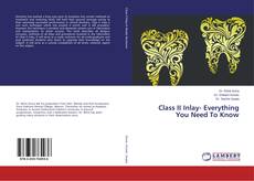 Copertina di Class II Inlay- Everything You Need To Know