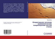 Buchcover von Оперативное лечение травматических повреждений костей стопы