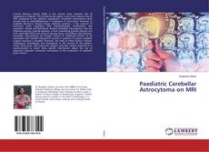 Buchcover von Paediatric Cerebellar Astrocytoma on MRI