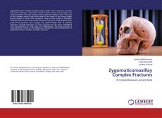 Buchcover von Zygomaticomaxillay Complex Fractures