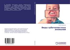 Buchcover von Виды зубочелюстных аномалий