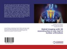 Copertina di Hybrid imaging with 3D reconstruction:a new tool in lumbar arthrodesis
