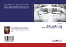Buchcover von Radiopacities and Radiolucencies of Jaws