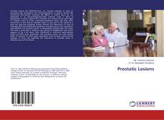 Copertina di Prostatic Lesions