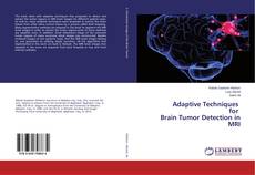 Buchcover von Adaptive Techniques for Brain Tumor Detection in MRI
