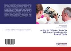 Copertina di Ability Of Different Posts To Reinforce Endodontically Treated Teeth