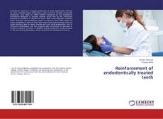 Copertina di Reinforcement of endodontically treated teeth