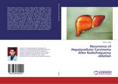 Copertina di Recurrence of Hepatocellular Carcinoma After Radiofrequency ablation