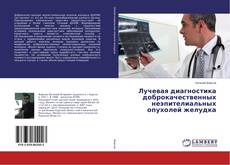 Copertina di Лучевая диагностика доброкачественных неэпителиальных опухолей желудка