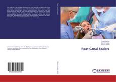 Copertina di Root Canal Sealers