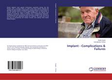 Buchcover von Implant - Complications & Failures