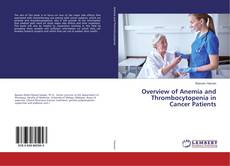 Bookcover of Overview of Anemia and Thrombocytopenia in Cancer Patients