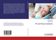 Copertina di Pit and Fissure Sealants
