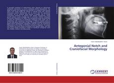 Couverture de Antegonial Notch and Craniofacial Morphology