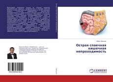 Copertina di Острая спаечная кишечная непроходимость