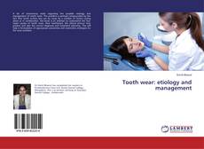 Copertina di Tooth wear: etiology and management
