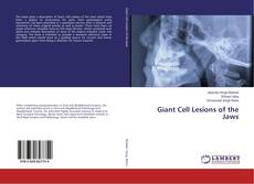 Buchcover von Giant Cell Lesions of the Jaws